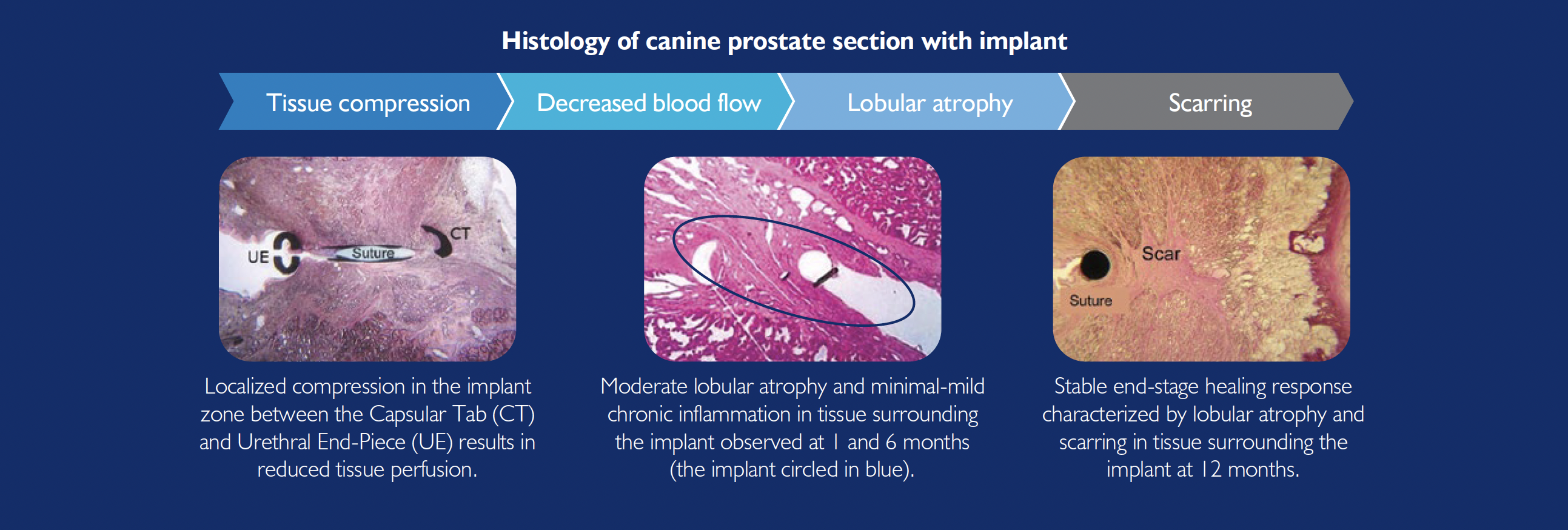 Histology of canine prostate section with implant