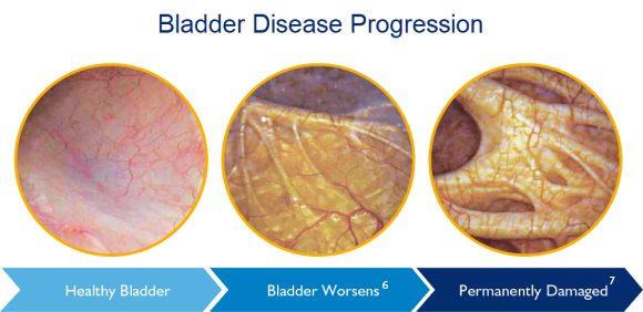 bladder stages