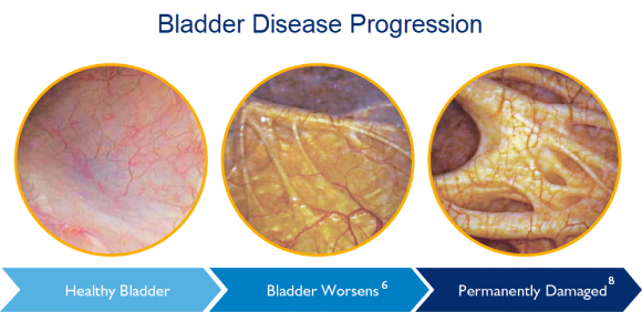 Bladder Disease Progression