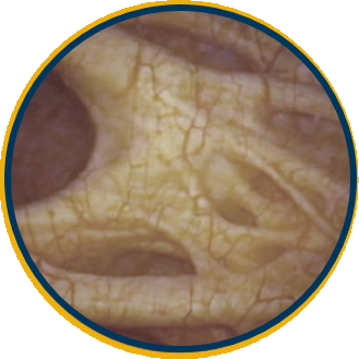 Unhealthy Bladder - New